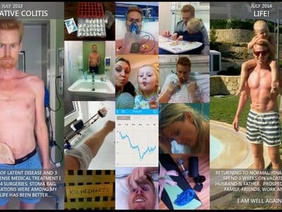Recovery from ulcerative colitis — July 2013 hospital and surgeries to July 2014 back with family. The turning point that re-based everything.